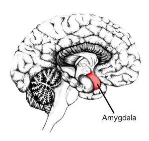 Amygdala enlargement in anxiety and depression
