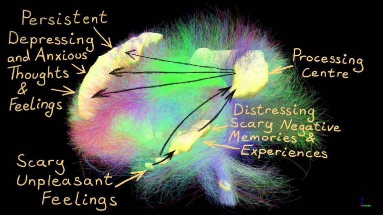 Brain scan of depressed brain