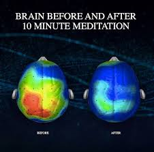 Brain scan before and after meditation