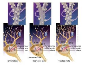 Inflammation damages synapses inflammation damages synapses
